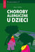 Książka ePub Choroby alergiczne u dzieci - brak