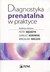 Książka ePub Diagnostyka prenatalna w praktyce - praca zbiorowa