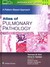 Książka ePub Atlas of Pulmonary Pathology - Mahmood Butt Yasmeen, Tazelaar Henry D.