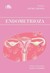 Książka ePub Endometrioza Seema Chopra ! - Seema Chopra