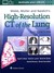 Książka ePub Webb, MÃ¼ller and Naidich's High-Resolution CT of the Lung Sixth edition - David Lynch, Desai Sujal, Devaraj Anand, Sverzellati Nicola, Elicker Brett M
